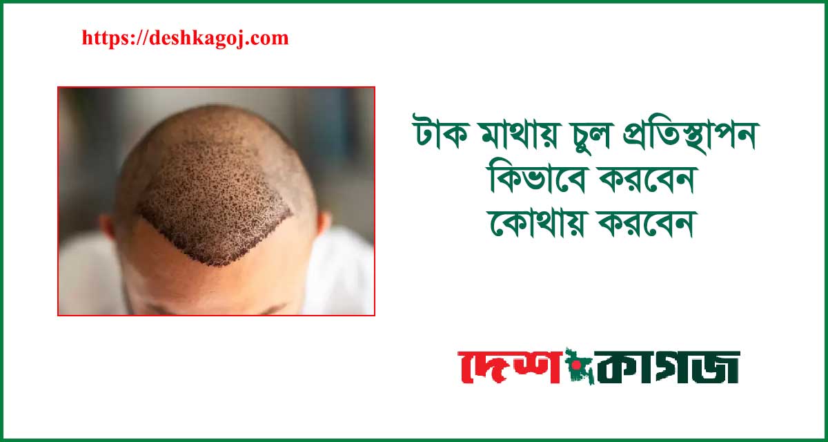 টাক মাথায় চুল