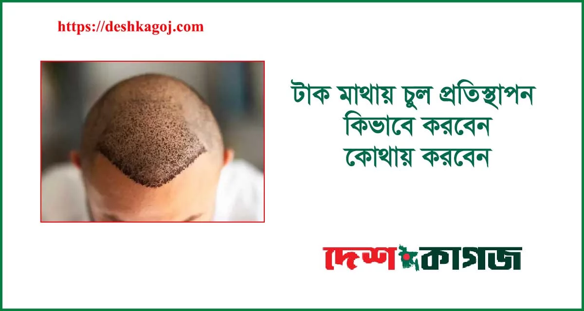 টাক মাথায় চুল